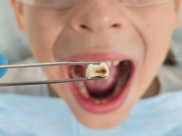 Best Emergency Pediatric Dentist  in Warroad, MN